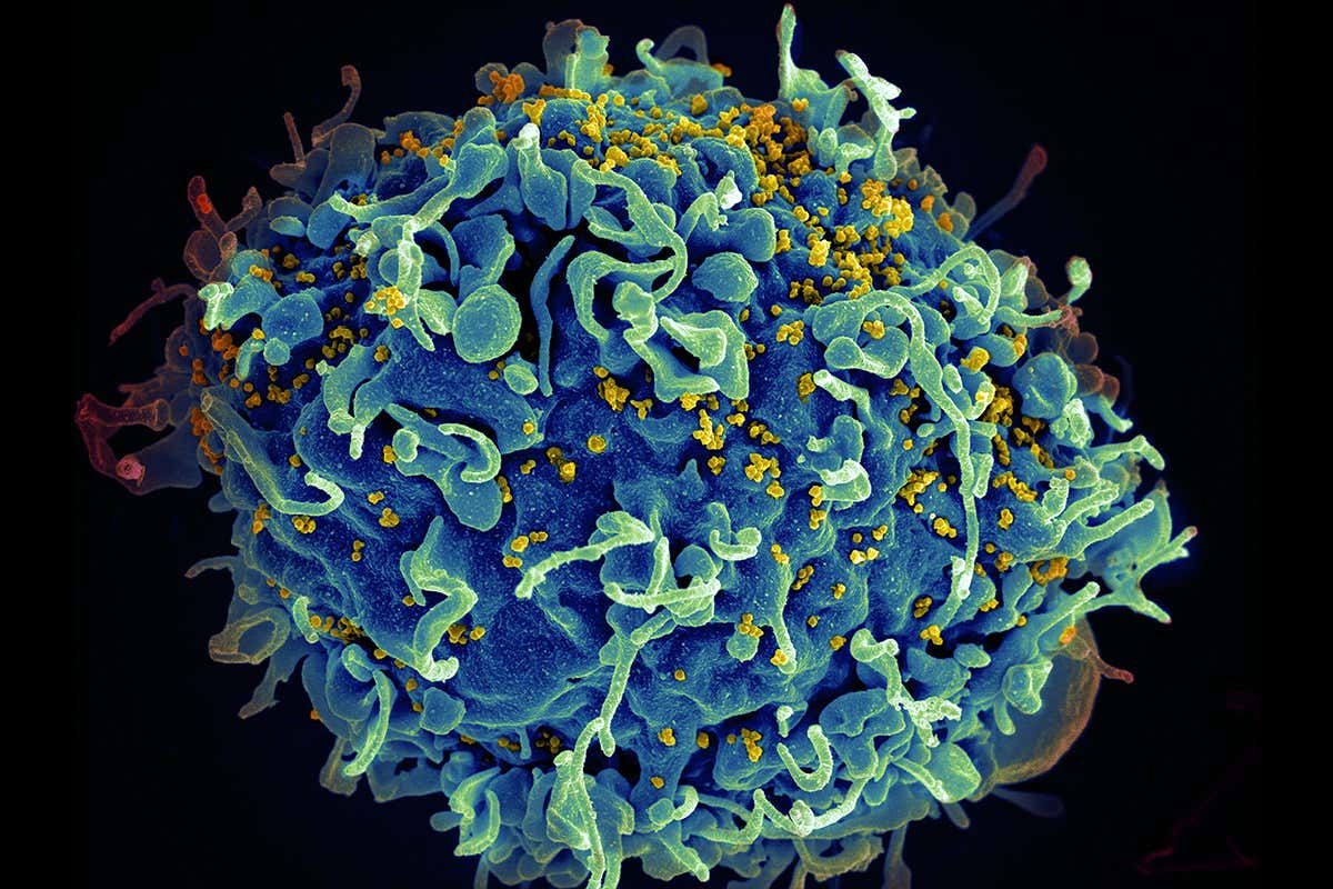 A T cell under attack from HIV