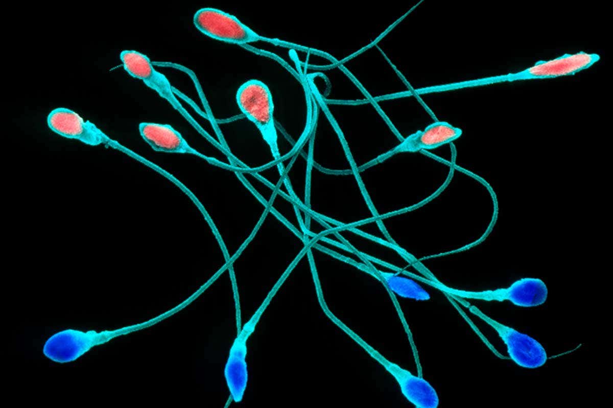 Electron micrograph of sperm