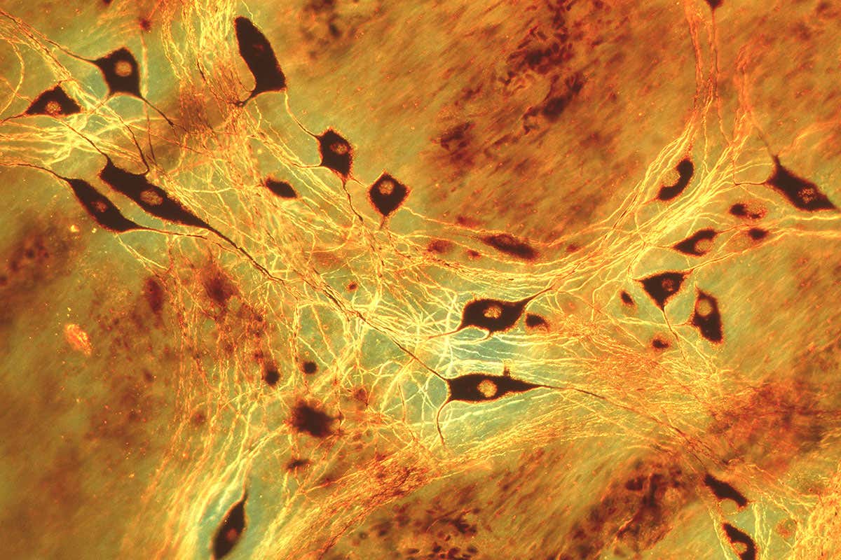 Nerve cells in small intestine