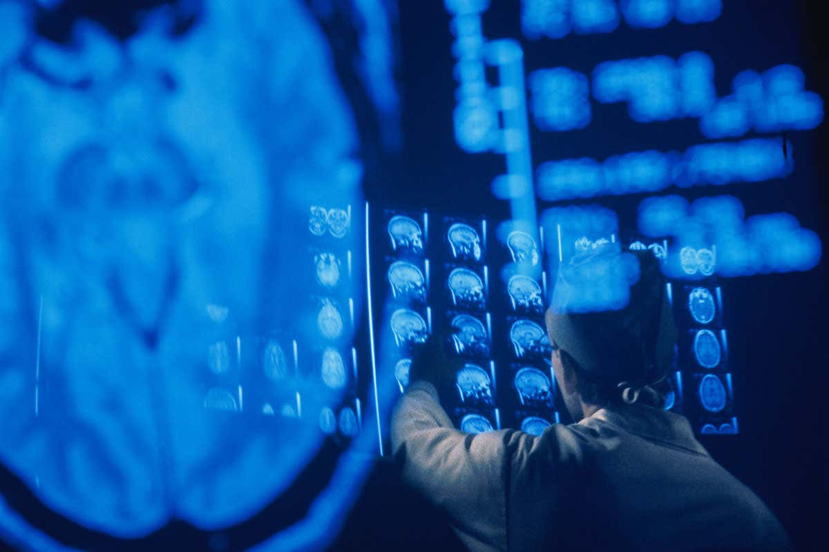 Looking at an MRI scan