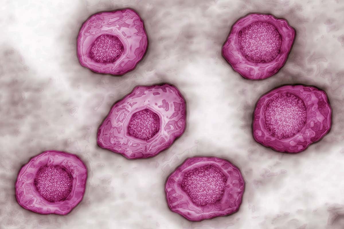 Epstein-Barr viruses