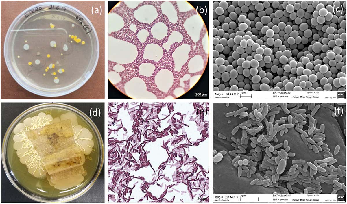 Bacteria detected on the painting: Samples were collected from the front (a, b, c) and the back (d, e, f) of the painting.