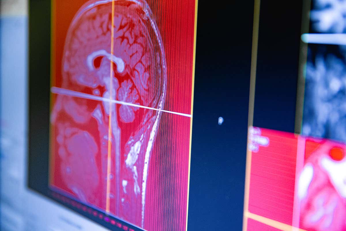 Brain scan, coloured