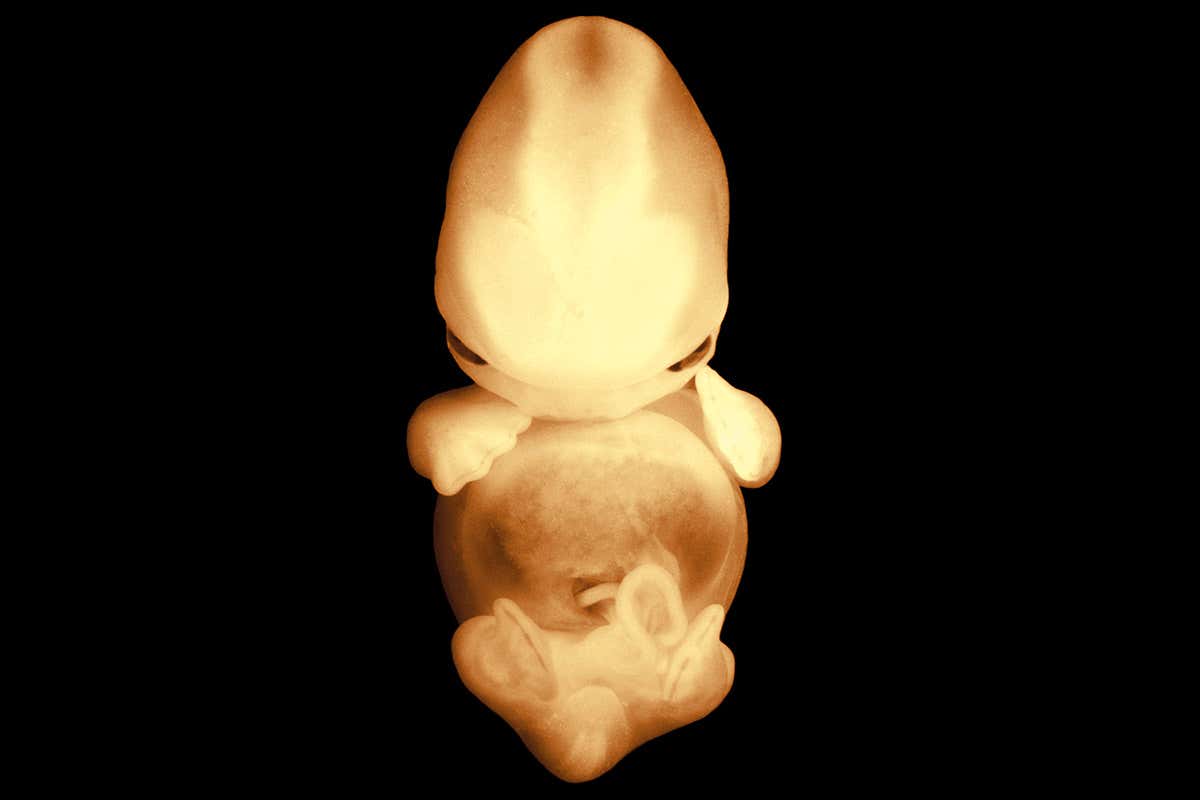 embryo