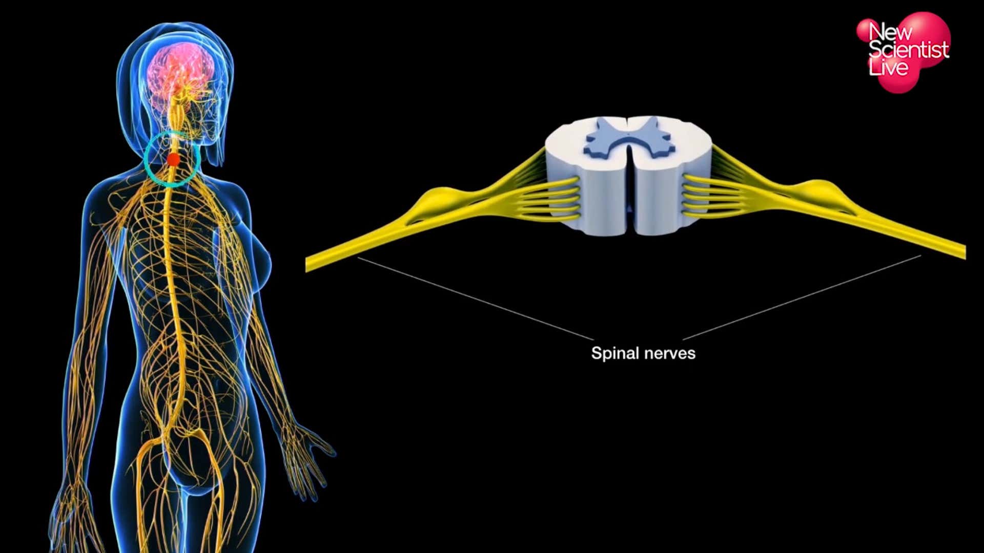 Preventing and overcoming chronic pain