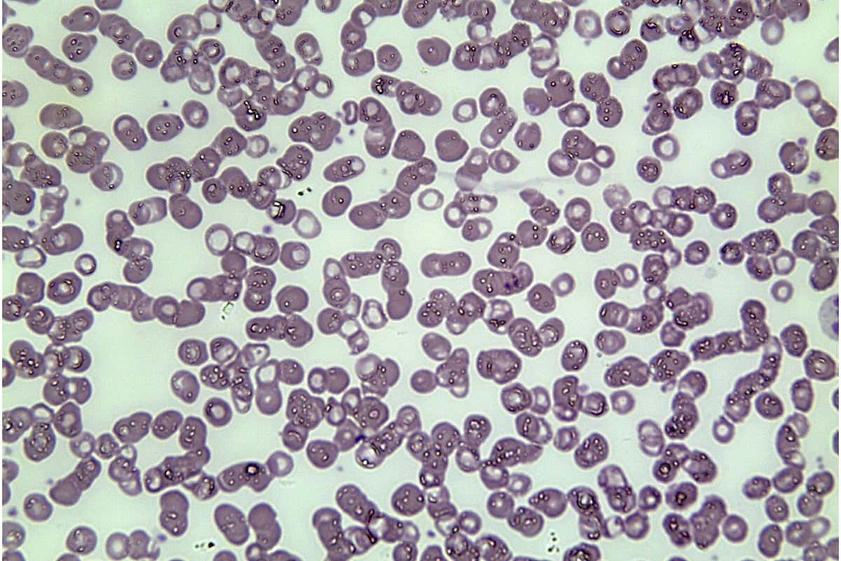 A microscope image of the "Spandau #7" blood sample