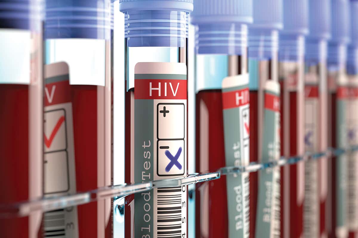 Several types of blood test can detect HIV
