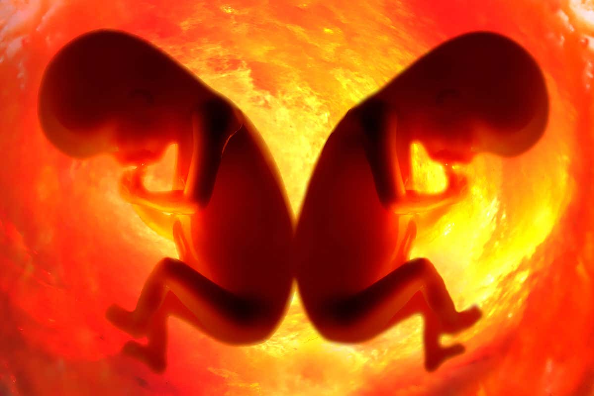 Twins in the womb