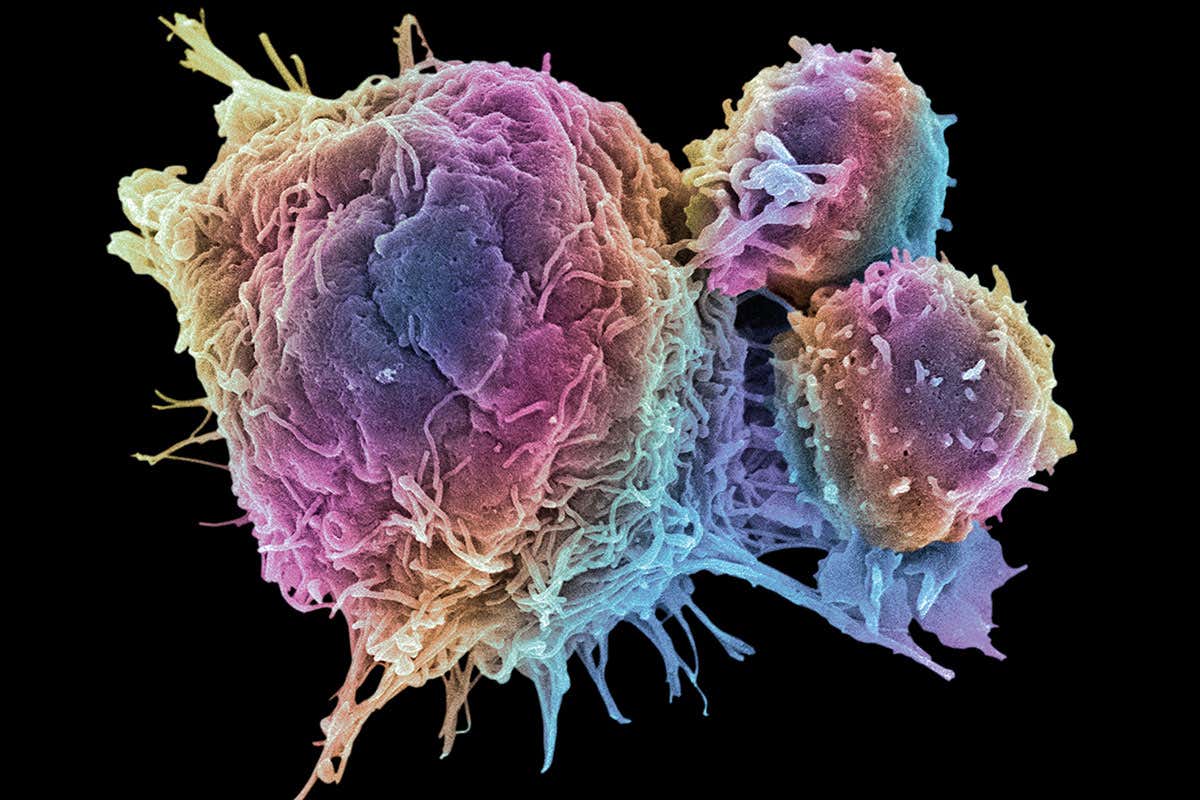 Cancer cells