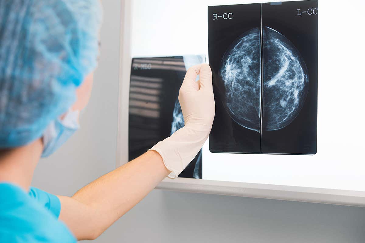 A mammogram