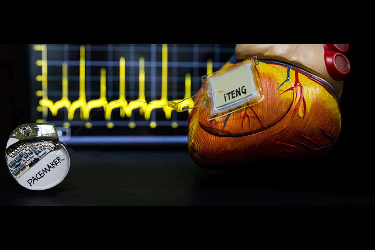 The symbiotic pacemaker based on implantable triboelectric nanogenerator.