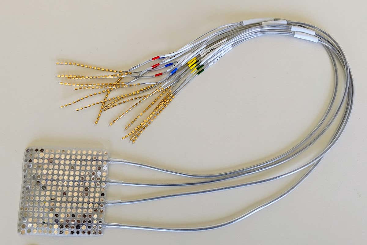 Image of an example array of intracranial electrodes of the type used to record brain activity in the current study.