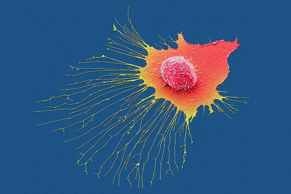A migrating breast cancer cells