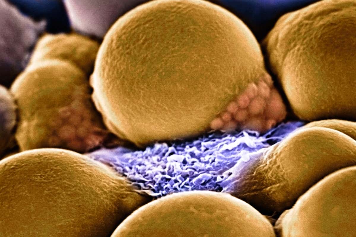 microscope image of bone fat cells