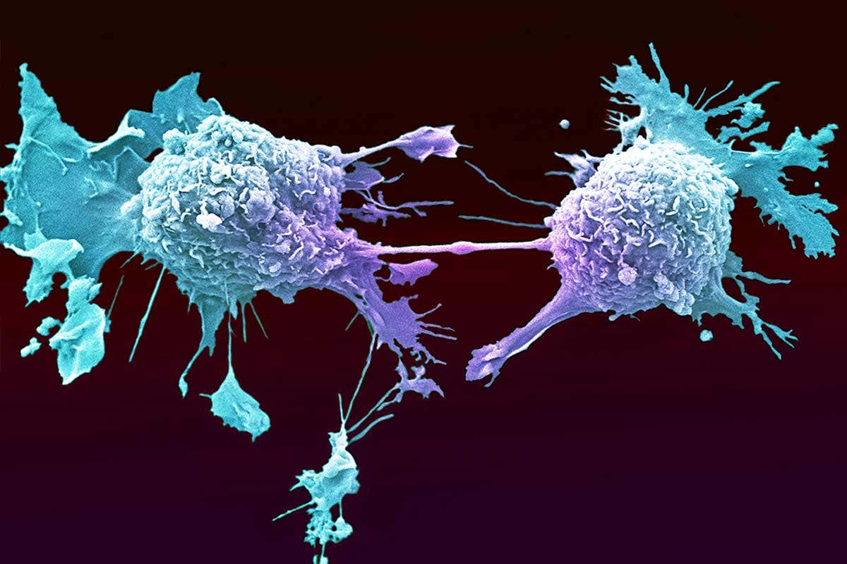 Lung cancer cells dividing