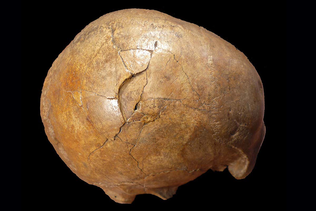 skull with fractures