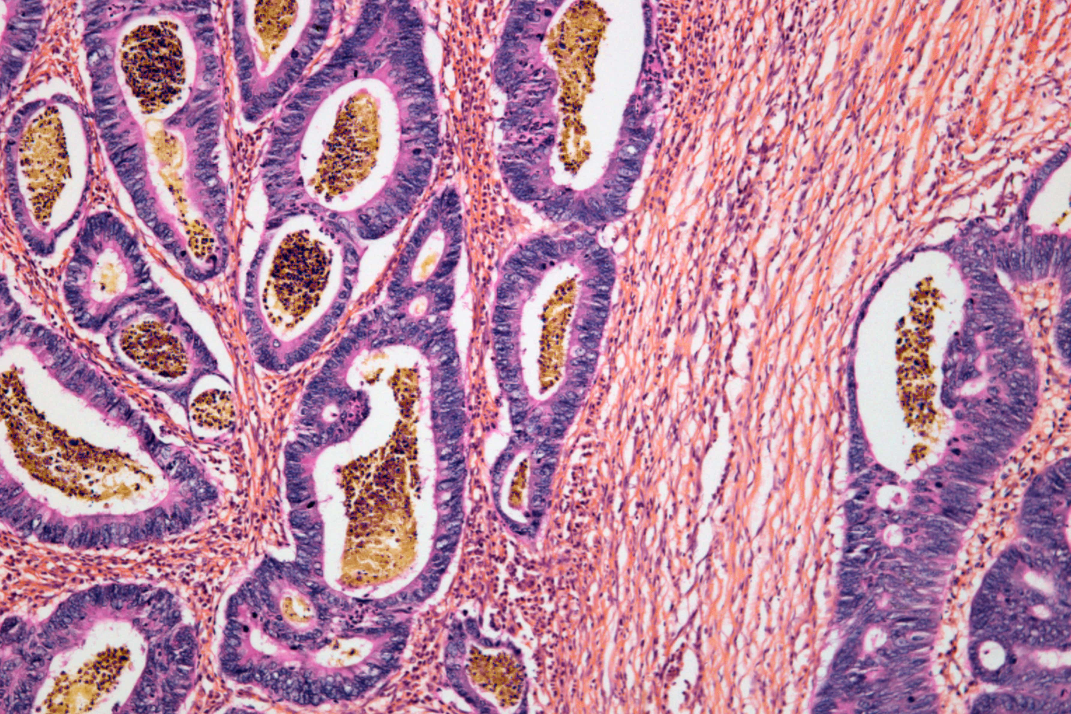 New Scientist. Science news and long reads from expert journalists, covering developments in science, technology, health and the environment on the website and the magazine.