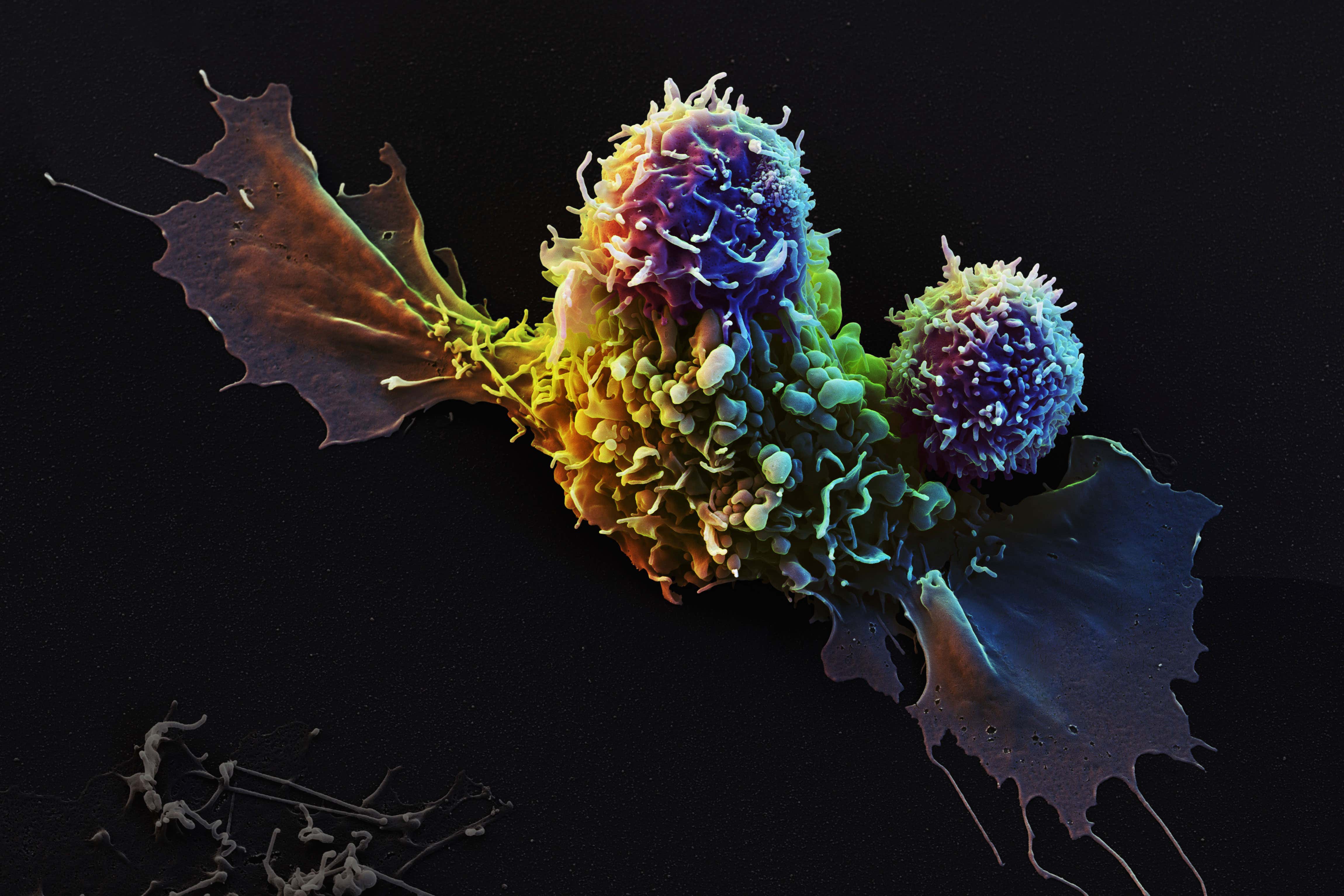 Immunotherapies can seek and destroy cancer cells