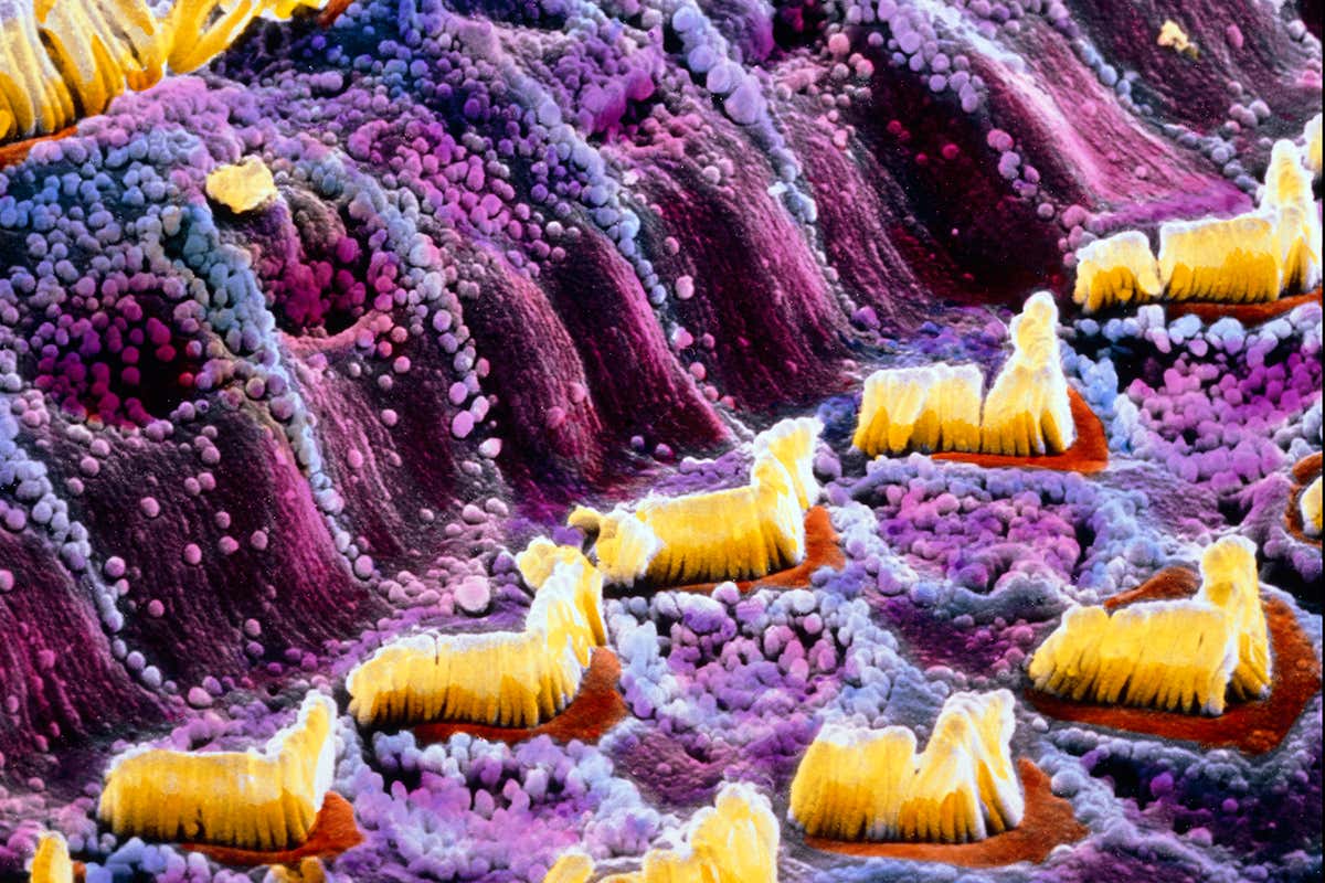 hair cells