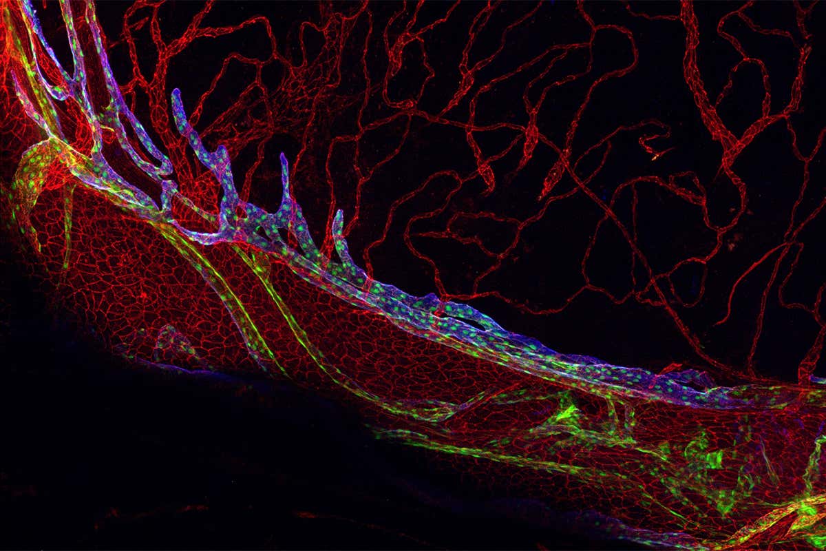 Meningeal lymphatic vessels remove toxins from the brain