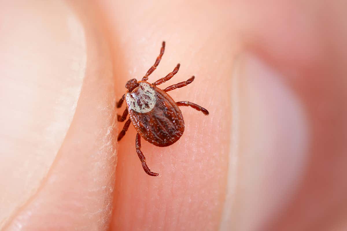 Lyme disease is a bacterial infection carried by ticks