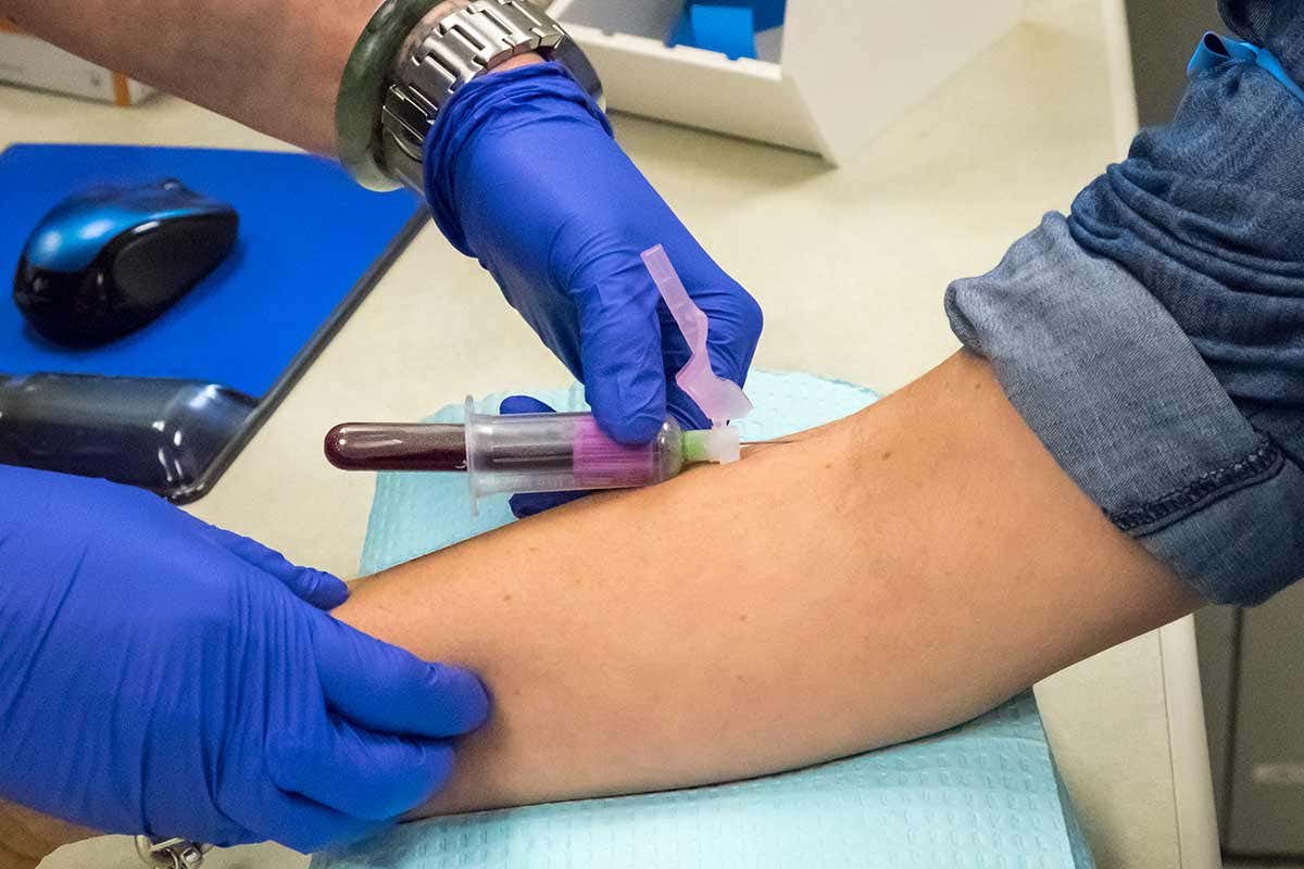 Personalised breast cancer test could tell when to stop treatment