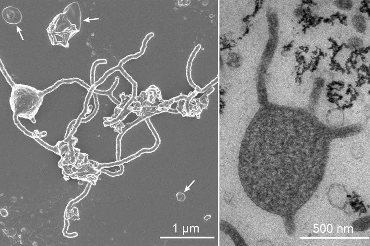 The team have imaged Prometheoarchaeum syntrophicum using electron microscopes