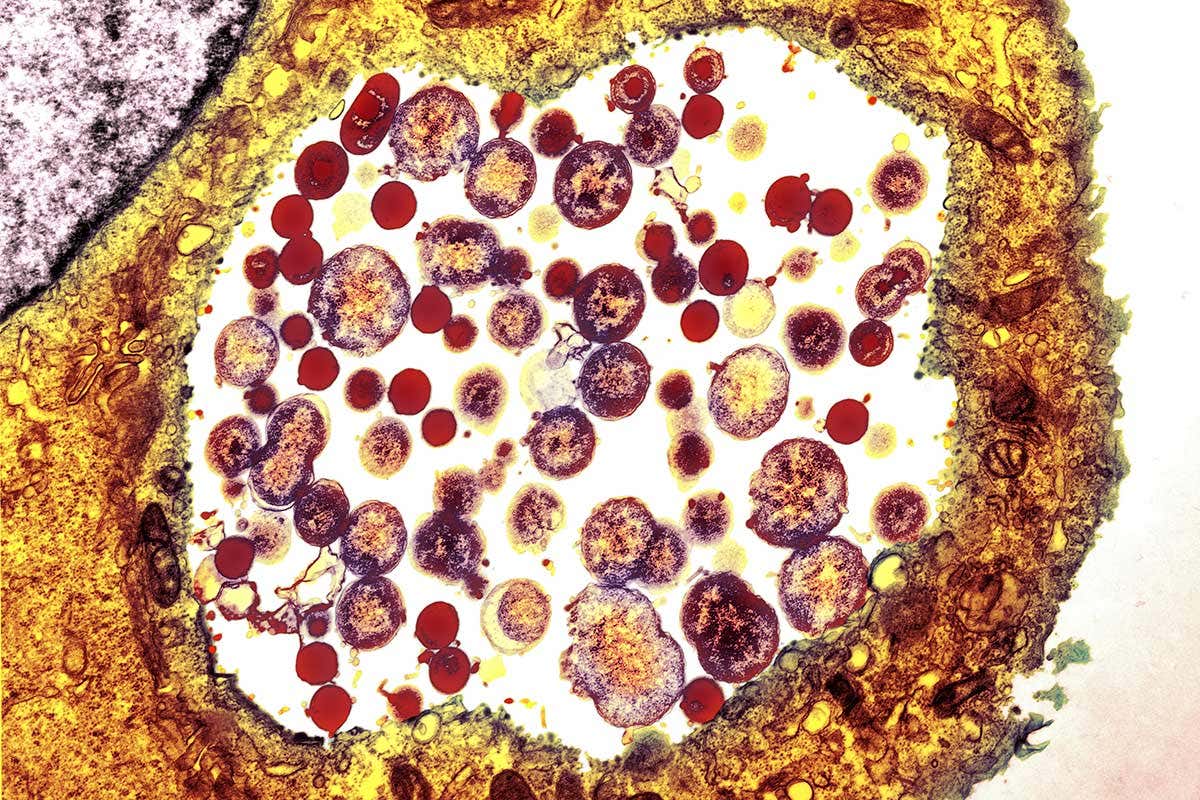 Chlamydia vaccine shown to be safe in first ever human trial