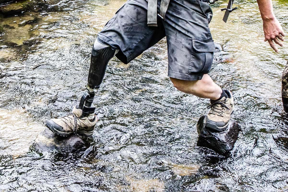 A picture of a prosthetic limb