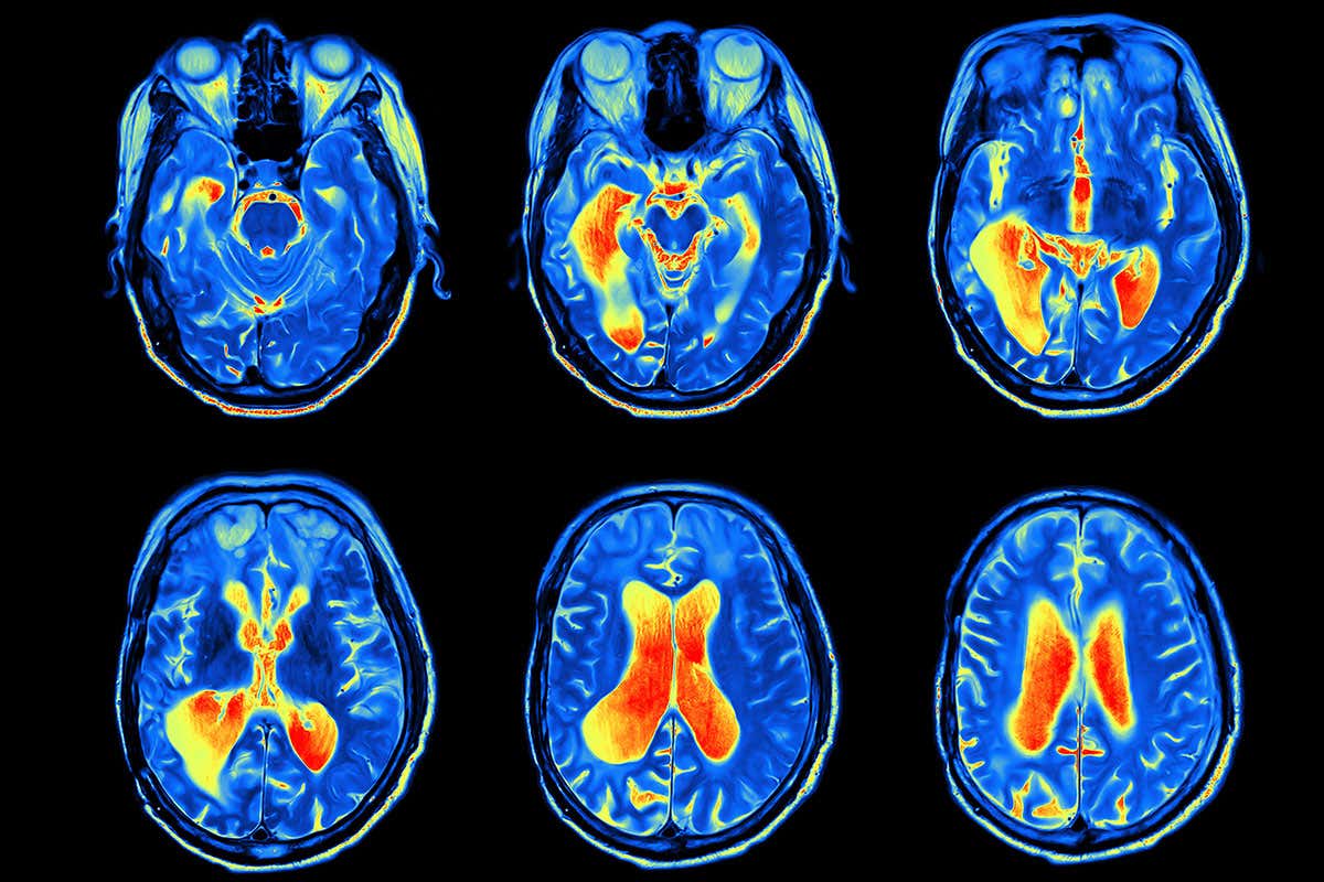 New Scientist. Science news and long reads from expert journalists, covering developments in science, technology, health and the environment on the website and the magazine.