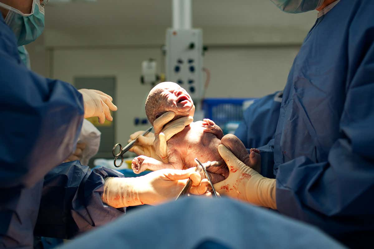 A baby born via c-section