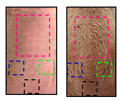 Picture of mouse skin before and after treatment