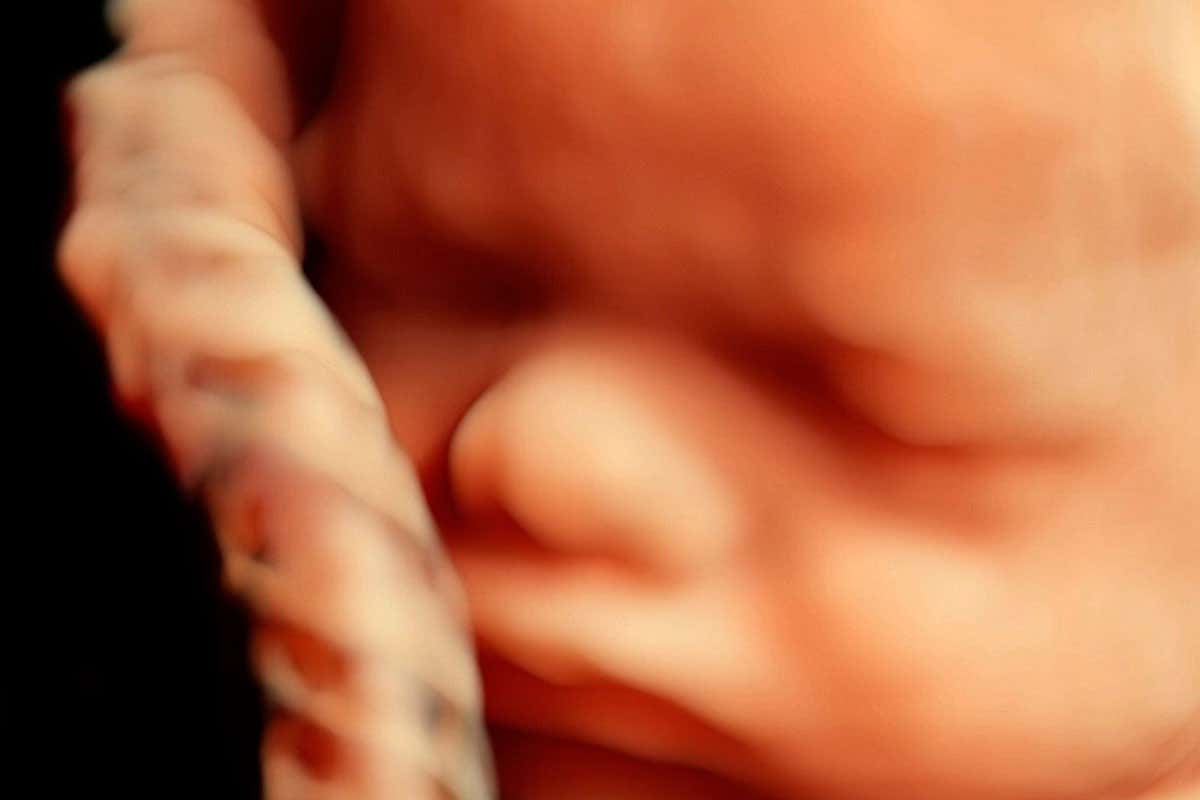Infections might alter brain development while in the womb