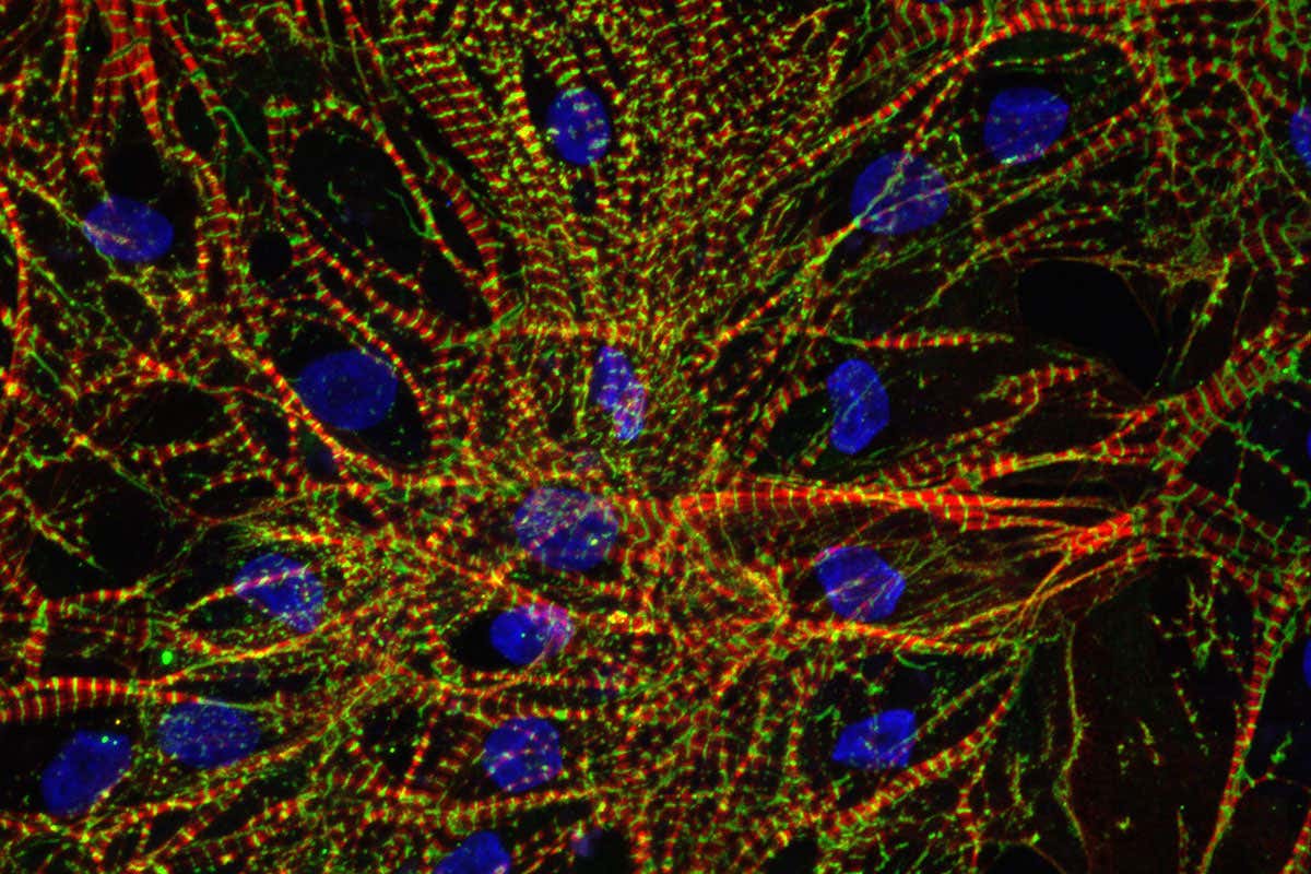 Immunofluorescence imaging of hiPSC-derived cardiomyocytes grown in microgravity aboard the ISS