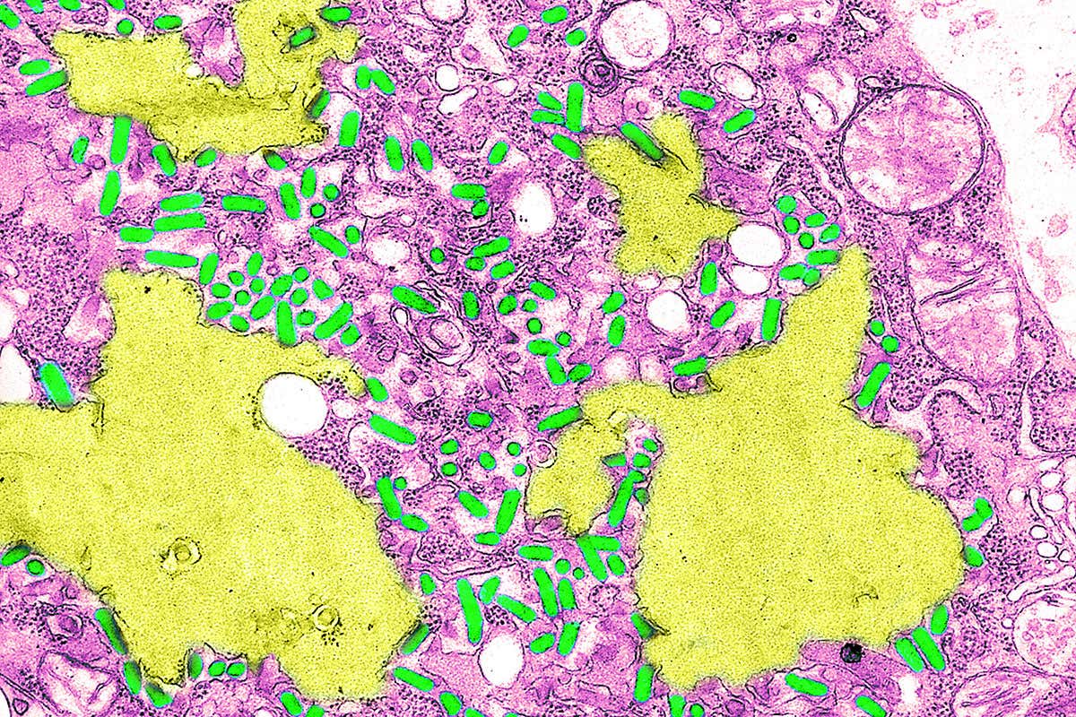 Transmission electron micrograph of the Rabies Virus. This electron micrograph shows the rabies virus (bright green), as well as Negri bodies (pale green), or cellular inclusions. The rabies virus is a neurotropic virus that causes fatal disease in human and animals. Rabies transmission can occur through the saliva of animals. The rabies virus has a cylindrical morphology and is the type species of the Lyssavirus genus of the Rhabdoviridae family. These viruses are enveloped and have a single stranded RNA genome with negative-sense. Negri bodies are eosinophilic, sharply outlined, pathognomonic inclusion bodies found in the cytoplasm of certain nerve cells containing the virus of rabies.