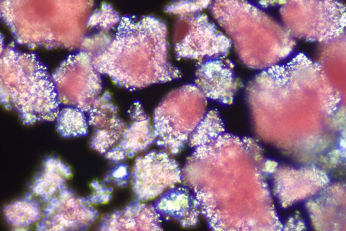 microplastic particles