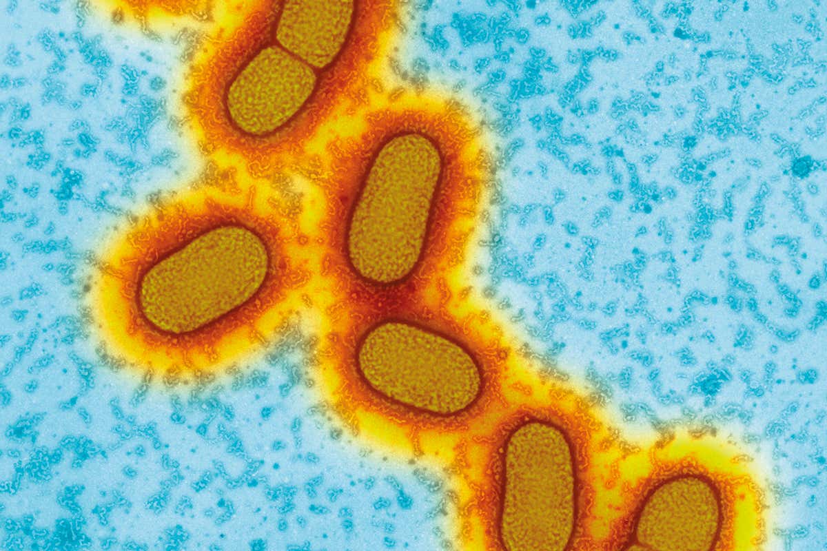 Porphyromonas gingivalis bacteria