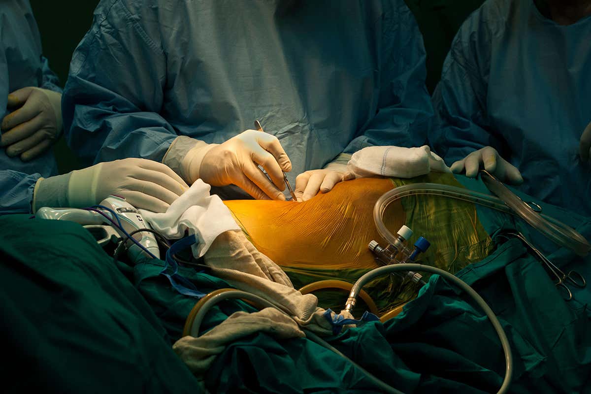 The start of surgery for a Kidney transplantation