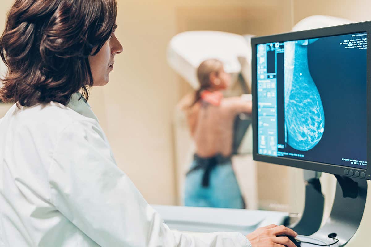 mammography