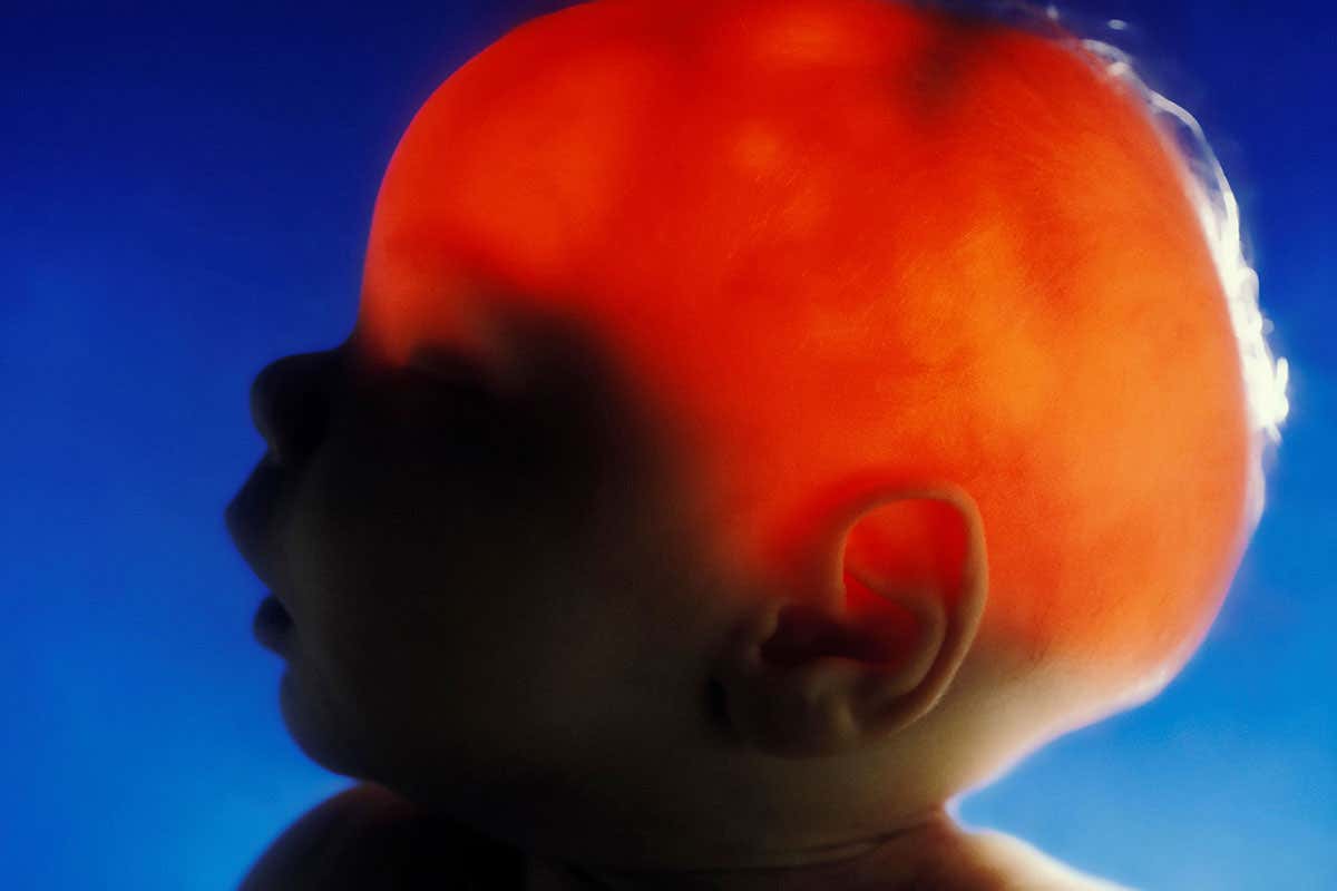 Teen born without half her brain has above average reading skills