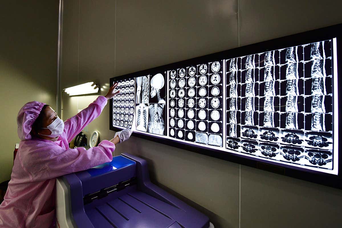 Medical imaging is being used to work out how the coronavirus affects the body