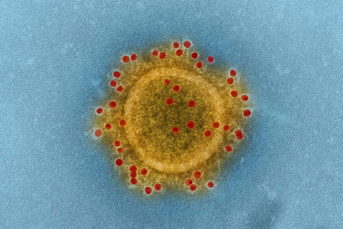 Middle East Respiratory Syndrome (MERS)
