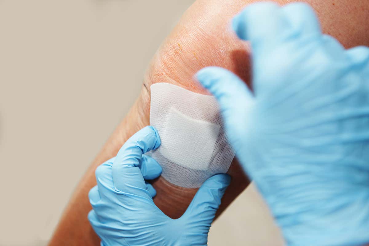 Wound-healing patch of blue-green algae mends skin quickly