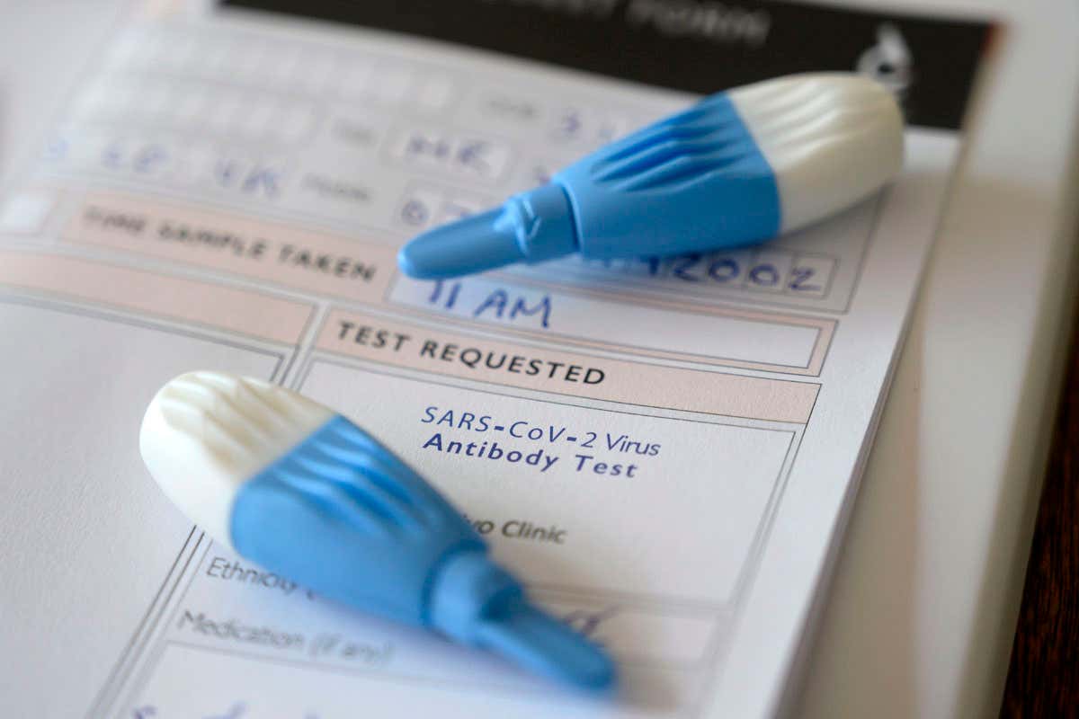 Issues with UK testing data are making it difficult to monitor the outbreak