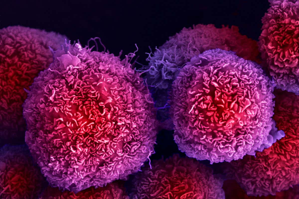 cancer cells