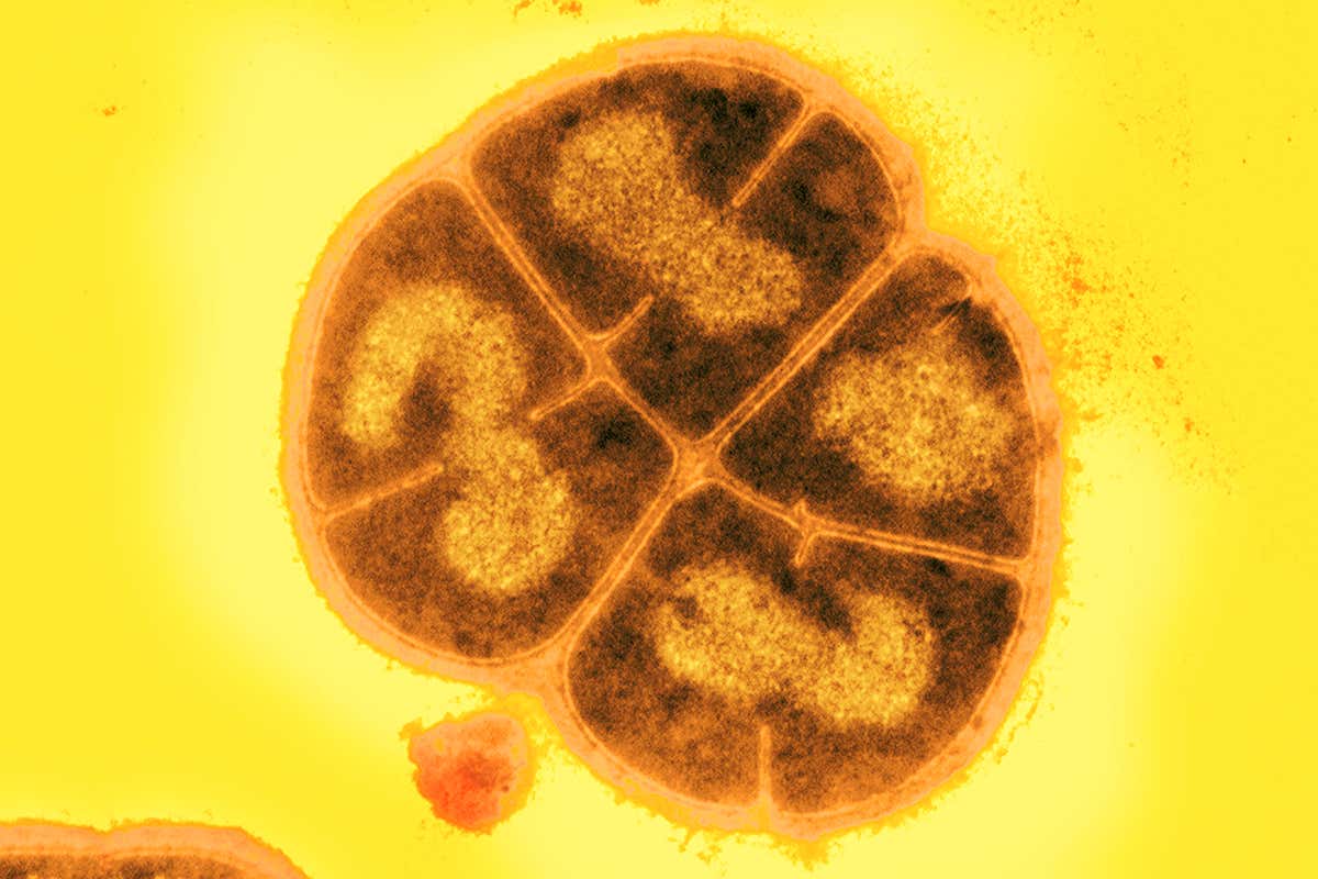 Deinococcus radiodurans