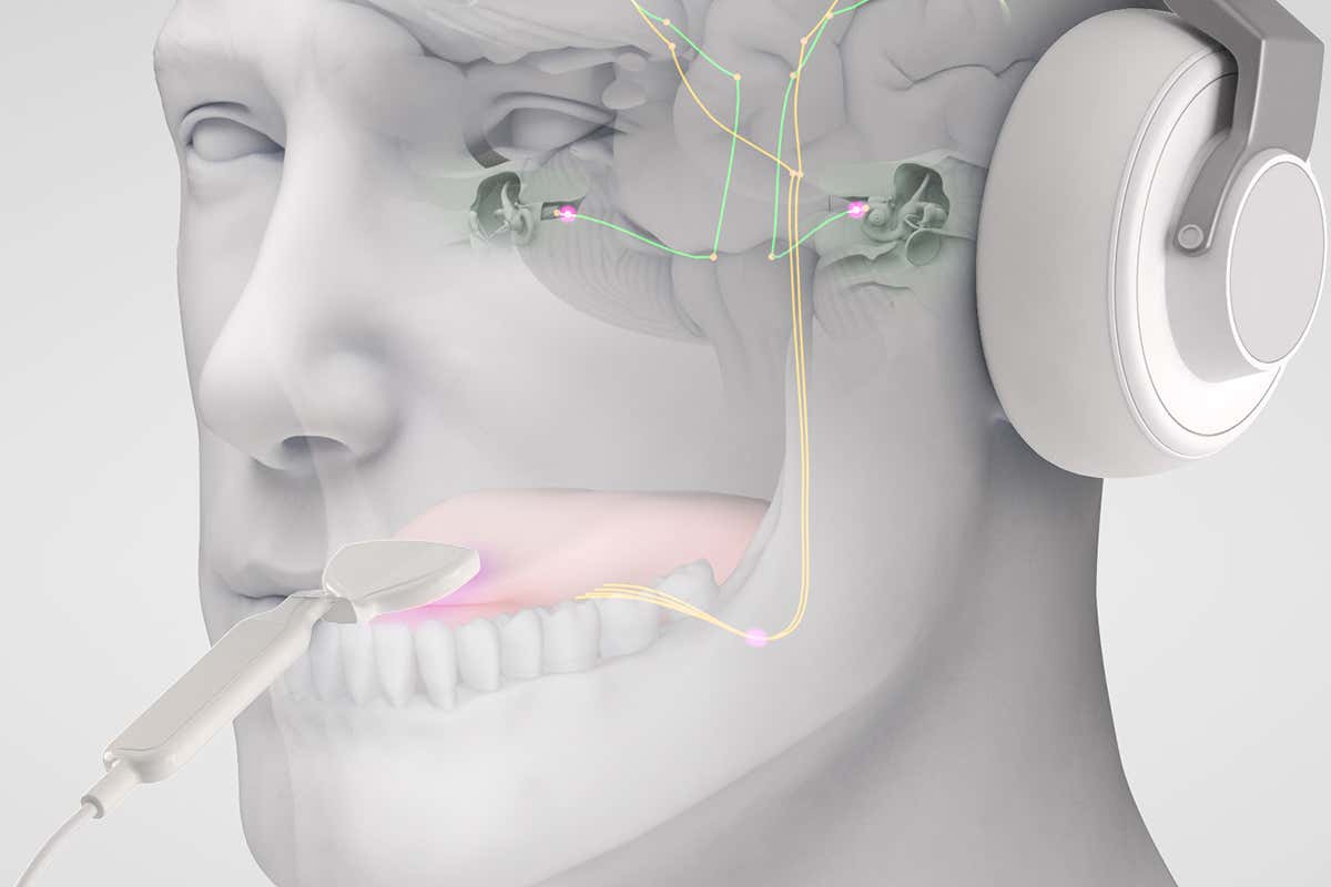 Stimulating the ears and tongue may reduce severity of tinnitus