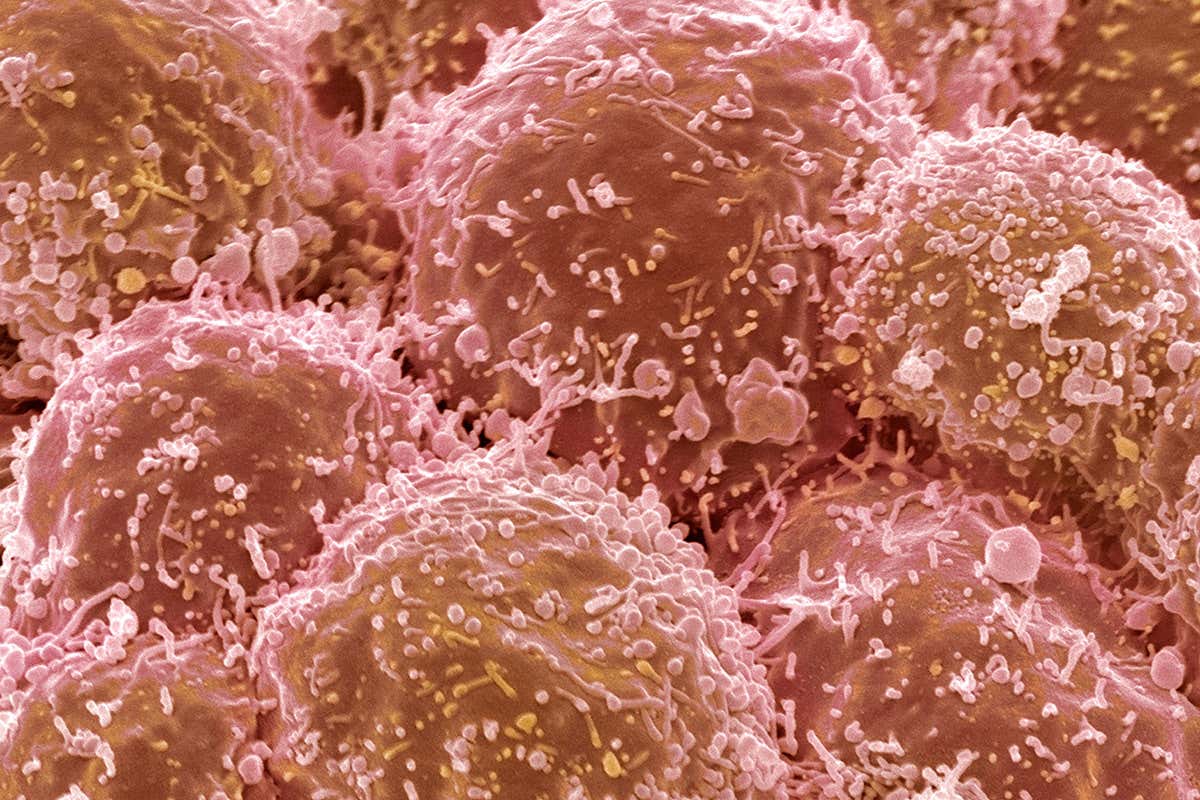 lung cancer cells