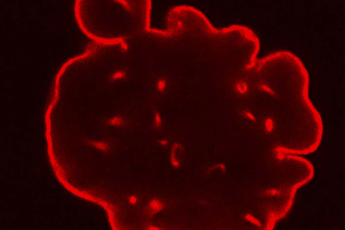 A cell from a person with progeria