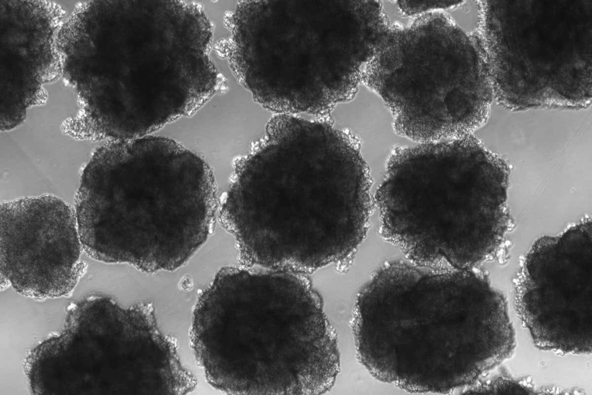 Mini brains genetically altered with CRISPR to be Neanderthal-like